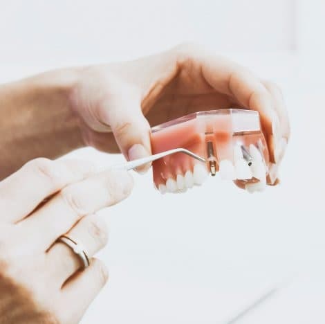 Implantes dentales en Sant Boi de Llobregat