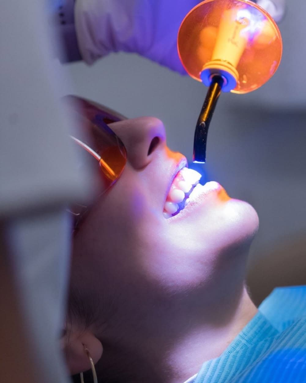Una sonrisa más luminosa de forma segura