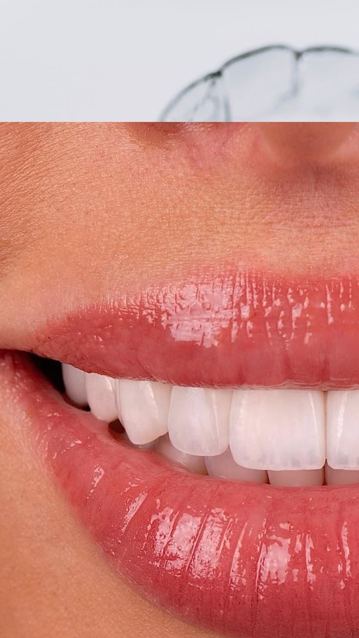 Estética Dental en Sant Boi de Llobregat