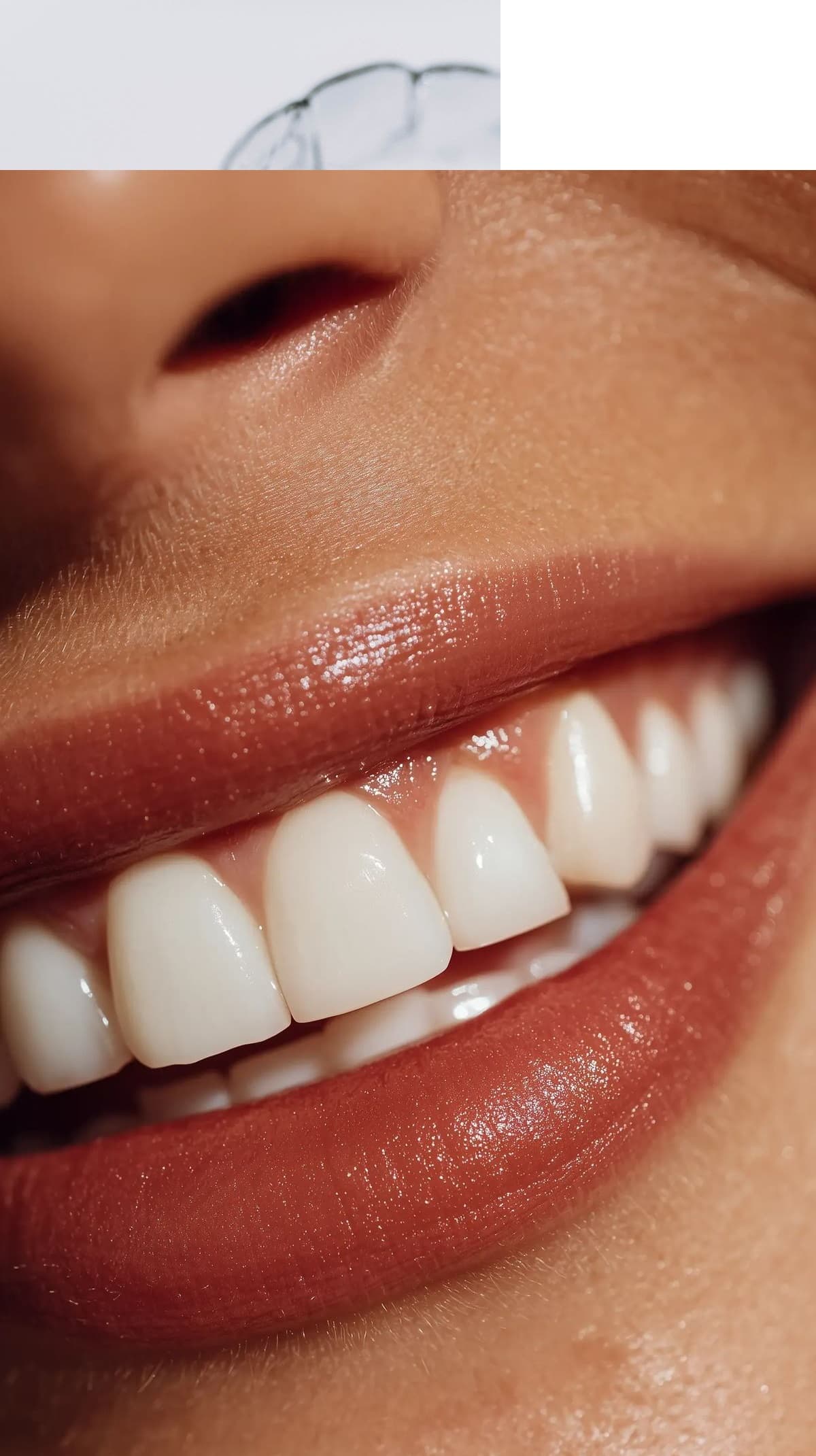 Diseñamos sonrisas naturales adaptadas a cada paciente