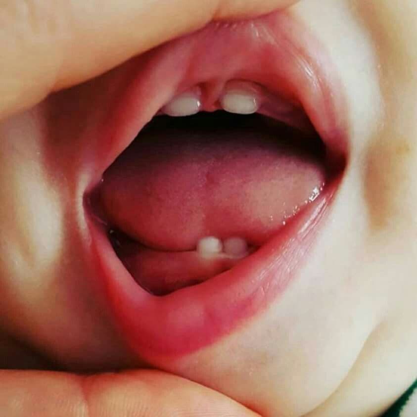 Odontopediatría en Sant Boi de Llobregat