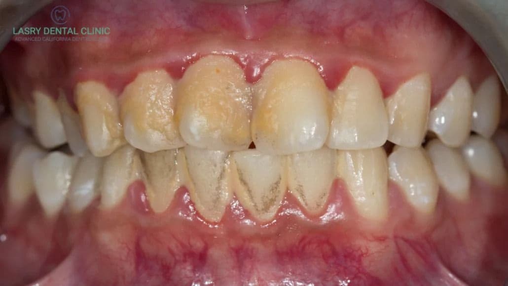 Periodoncia en Sant Boi de Llobregat