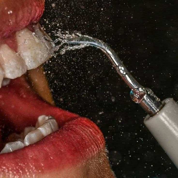 La salud de las encías es la base de una sonrisa sana
