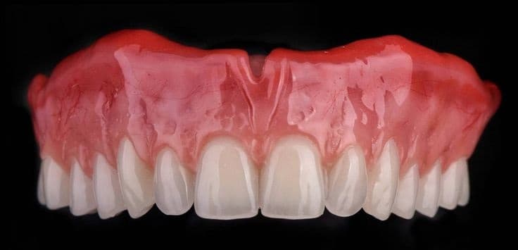 Prótesis Dentales en Sant Boi de Llobregat